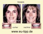 ZAHN-Behandlung CZ - Implantate ab Euro 490